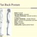 Flat Back Duruş Nedir?
