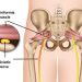 Piriformis Sendromu Nedir?
